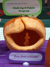 Cleft Lip Pumpkin