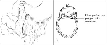 medical illustration